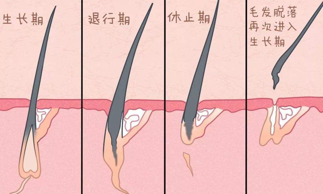脱发毛囊没闭合怎么治疗,脱发毛囊闭合怎么办