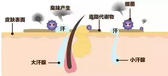 夏天热祛狐臭最佳时期,狐臭有羊膻味吗怎么治疗