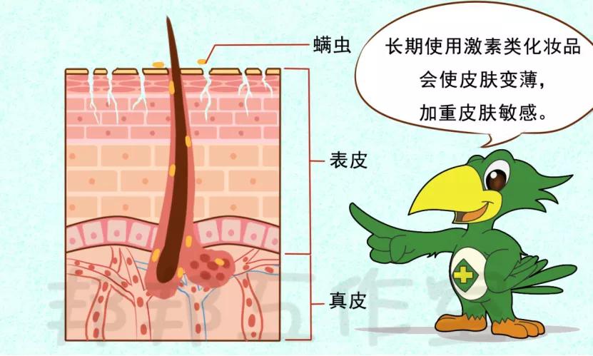 脚上用激素药膏会导致激素脸吗,激素脸形成的途径