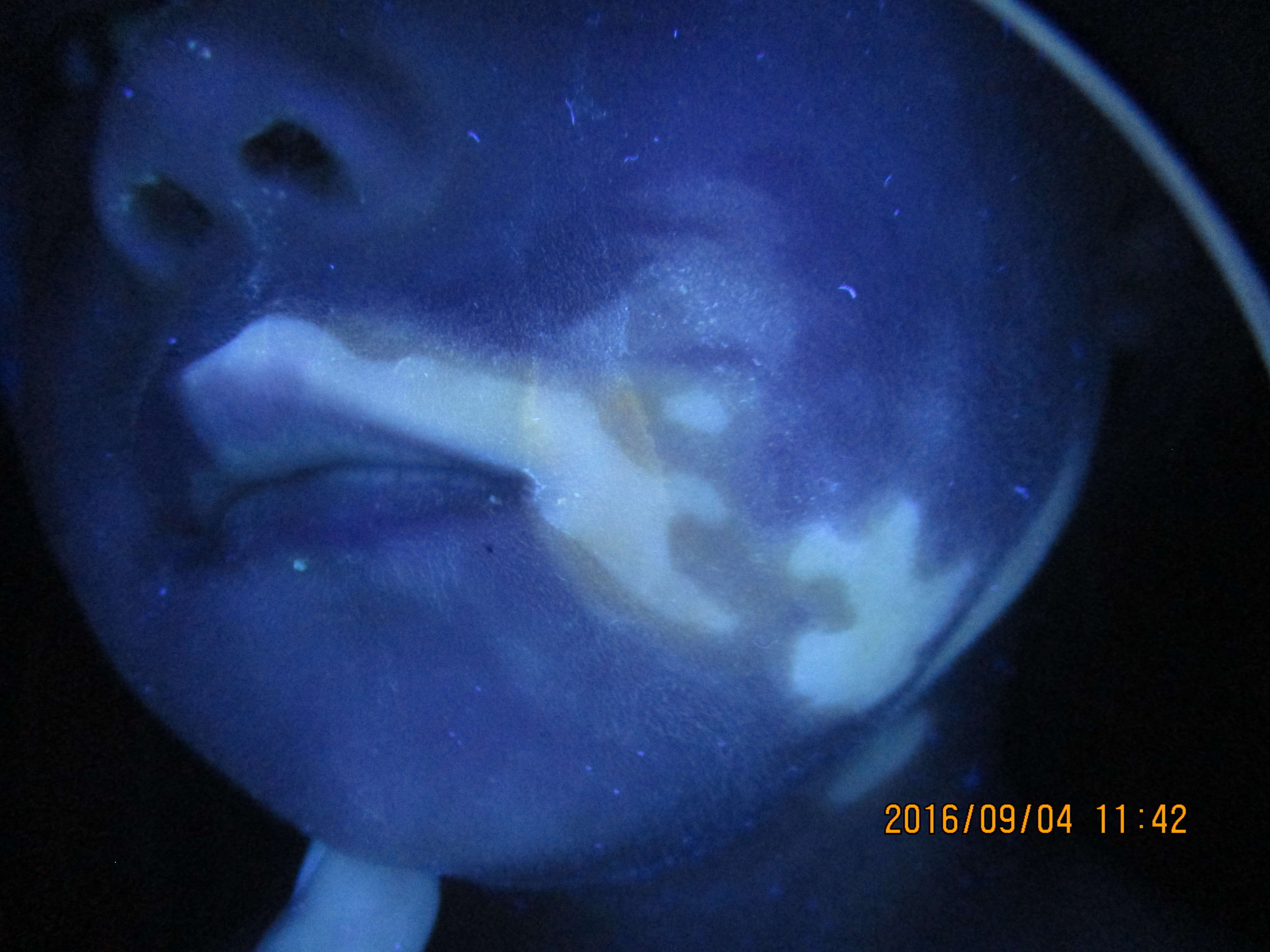 小孩脸上长白斑点什么问题,小孩脸上长白斑吃什么打虫药