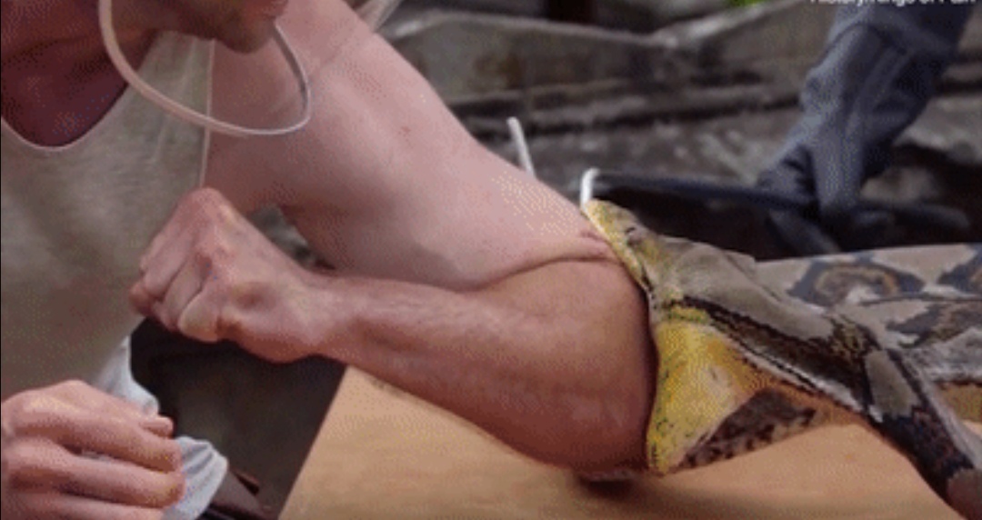 被毒蛇咬伤后蛇毒将最先到达哪里,被毒蛇咬伤和无毒蛇咬伤的区别