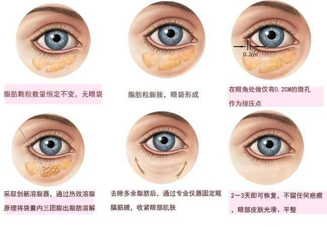 如何消除眼袋学生,如何消除眼袋男