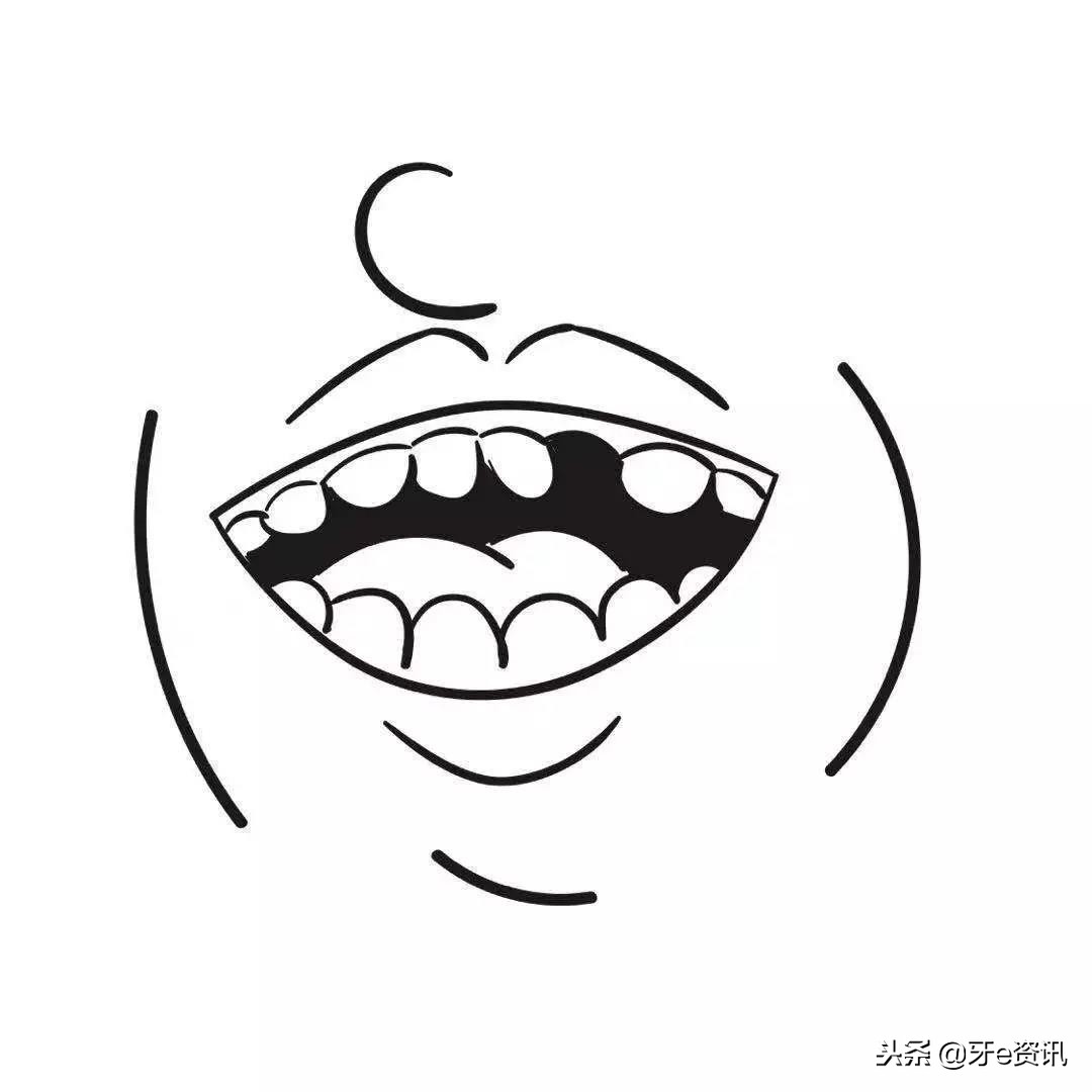 给你讲述最真实的种植牙过程,一张图可以告诉你各种牙套的区别