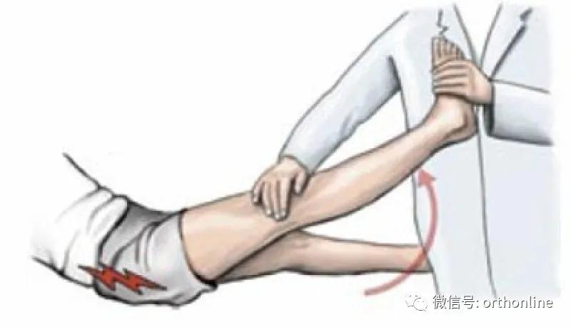 腰间盘突出坐骨神经痛怎么治最快,一招专治坐骨神经痛