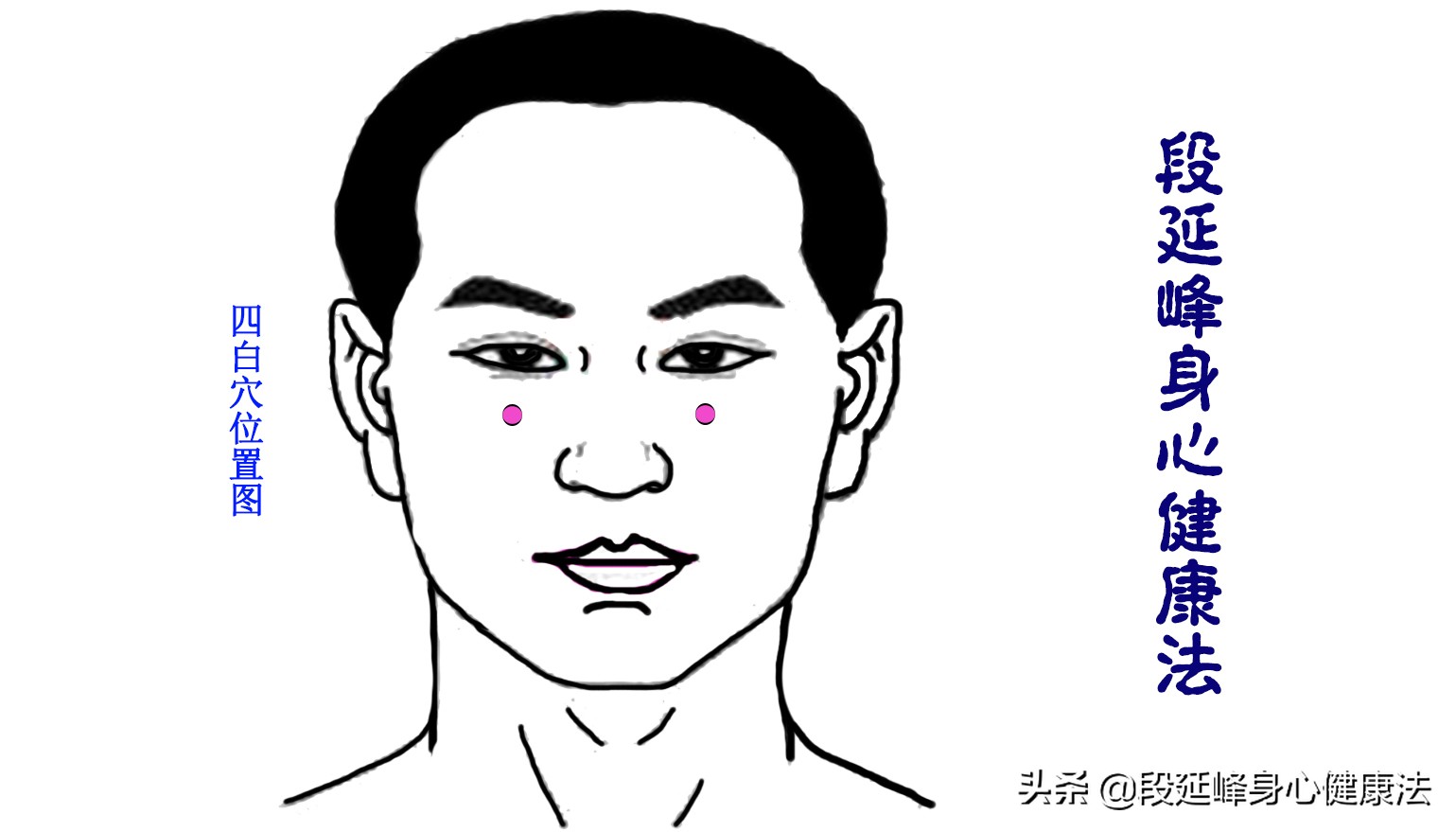 严重黑眼圈可以逆转吗,延峰治疗黑眼圈