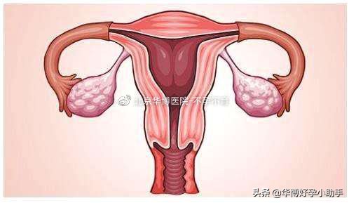 子宫最害怕的6种东西,子宫最怕的9件事