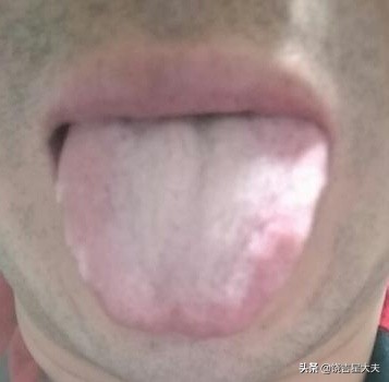 中医晚上口渴老想喝水什么原因,老中医告诉你一到晚上就口干