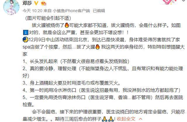 女子拔火罐烧伤,女明星拔火罐被烧伤真相令人后怕