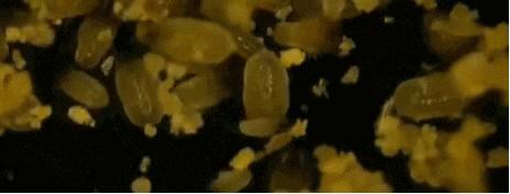 怎样去除头屑中的头皮屑,头皮屑多怎么办9个方法告别头屑