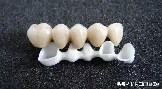氧化锆全瓷牙价格表,氧化锆全瓷牙和全瓷冠