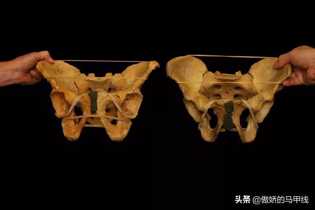 深蹲屁股眨眼如何改善,深蹲屁股眨眼正确吗