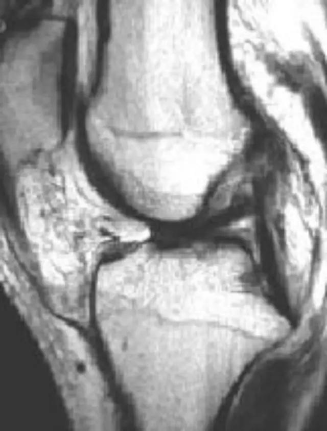mri临床医师必读电子书,临床医生如何读mri