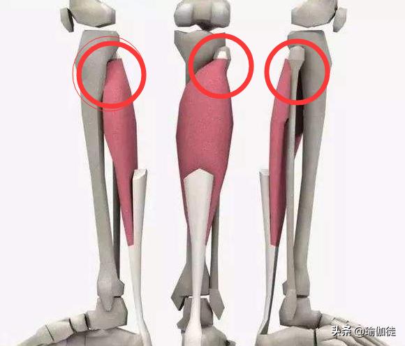 什么是膝盖过度伸展(膝盖超伸)?在瑜伽中怎么改善和正位?