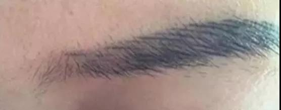 纹眉失败像什么,纹眉掉痂了眉毛怎么是红色