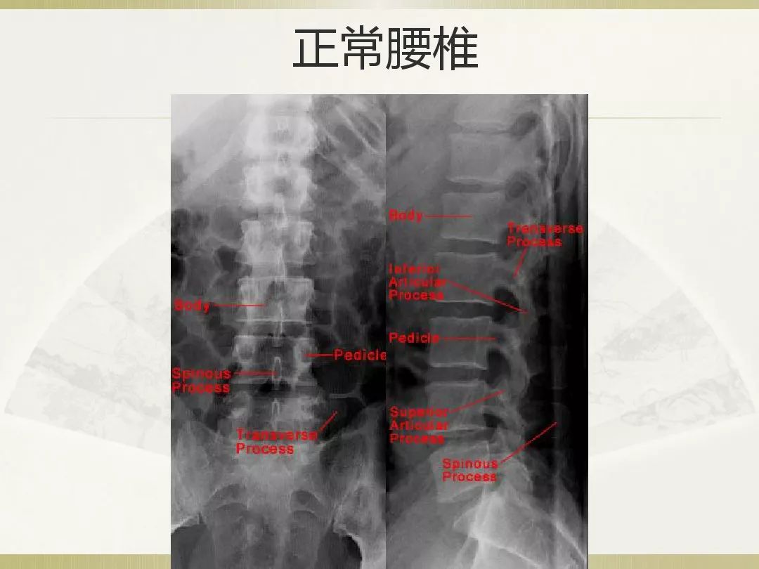 骨科x光片读片技巧,放射科骨科读片教程