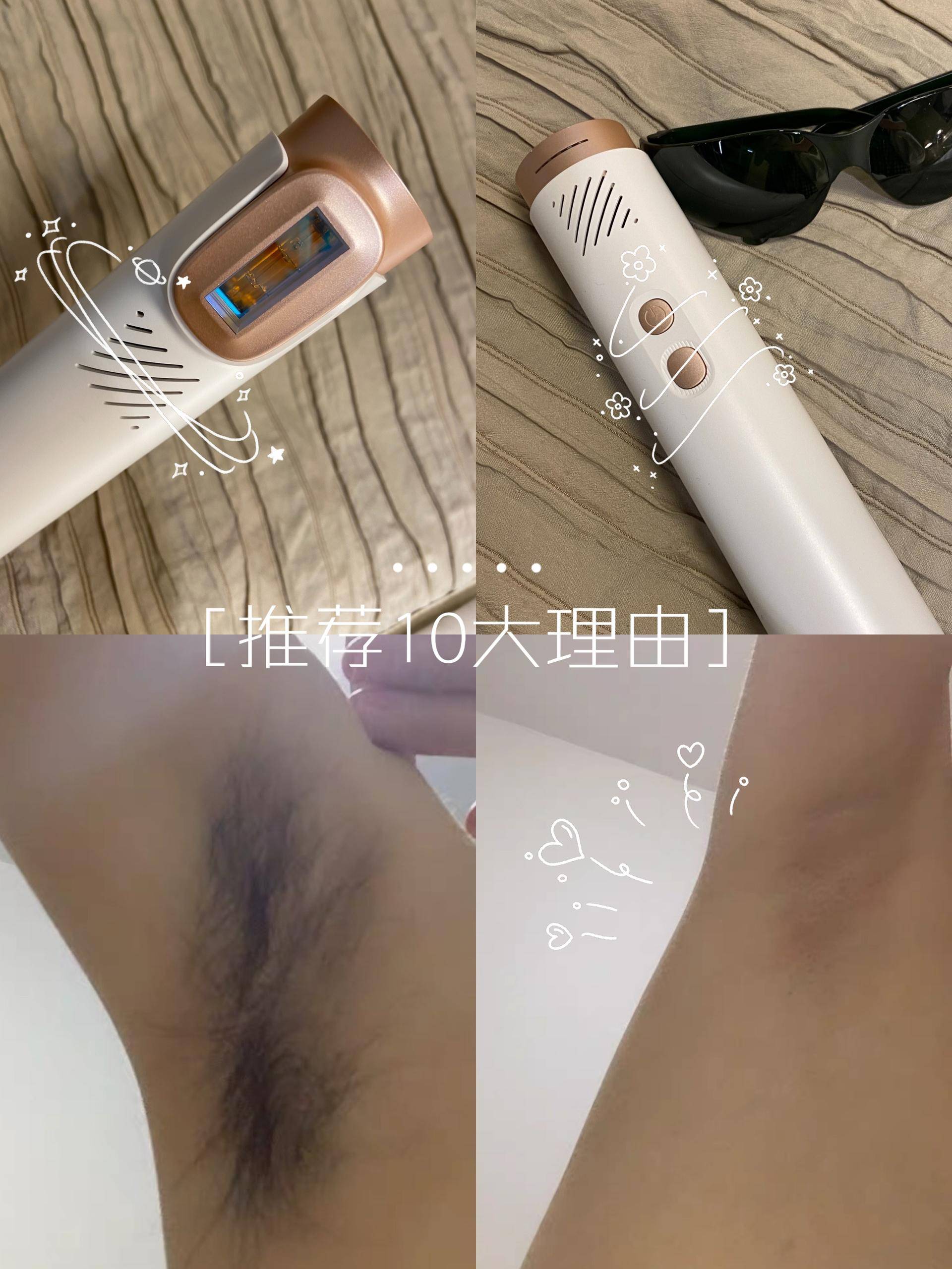 nextbeauty大白脱毛仪,nextbeauty脱毛仪真实测评