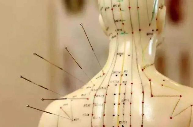 每天一次的针灸,针灸后越来越疼是好事还是坏事