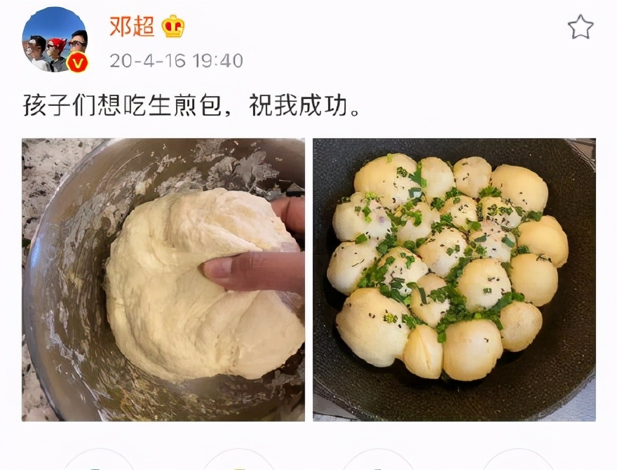 孙俪邓超扎针灸,邓超孙俪针灸