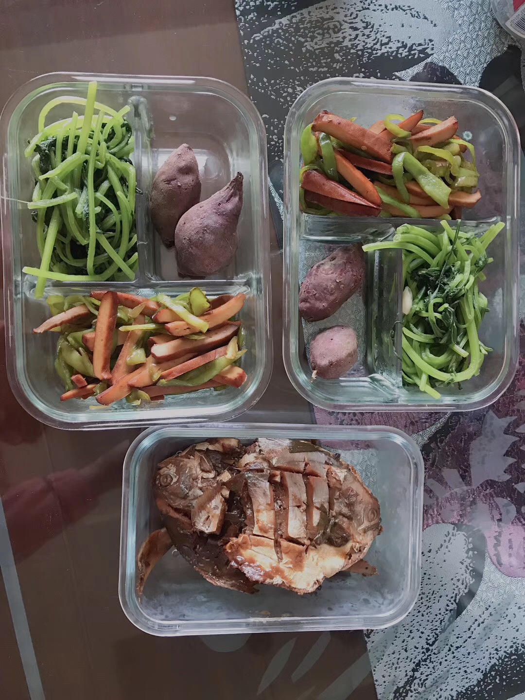 胆结石平时怎样才能把石头排出来,胆结石患者吃什么排石头