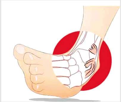 系紧鞋带可以预防崴脚吗,怎么样贴肌贴预防崴脚