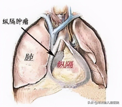 9个月大的孩子，总是咳咳咳咳咳咳咳咳咳咳，原因找到了