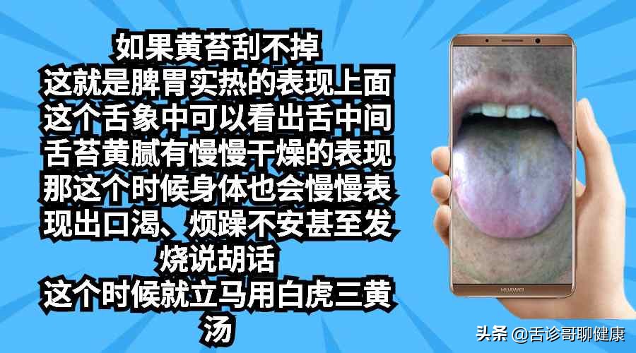 舌诊哥：遗精滑精、气短、虚汗、紧张、焦虑等舌象分析