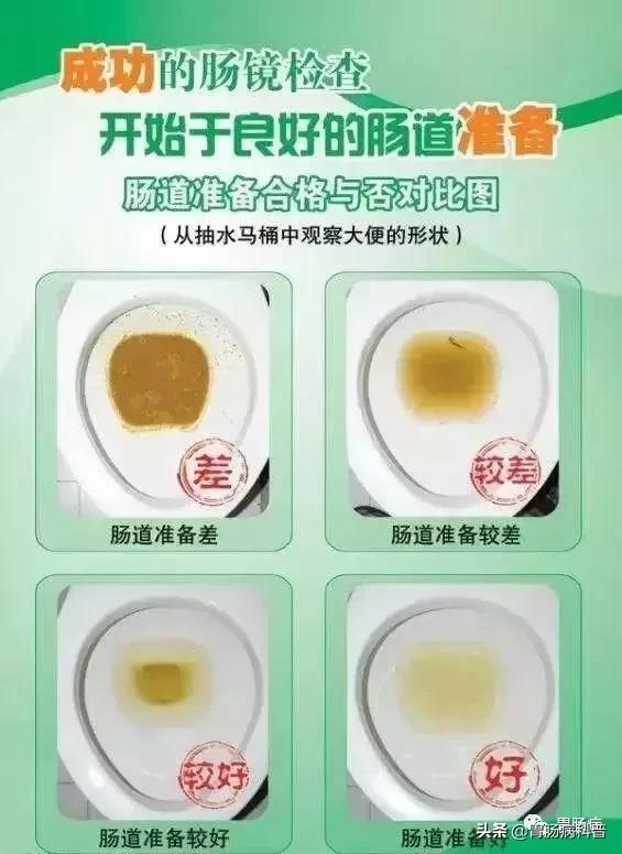 肠镜检查前后的注意事项有哪些,肠镜检查前后的注意事项是什么