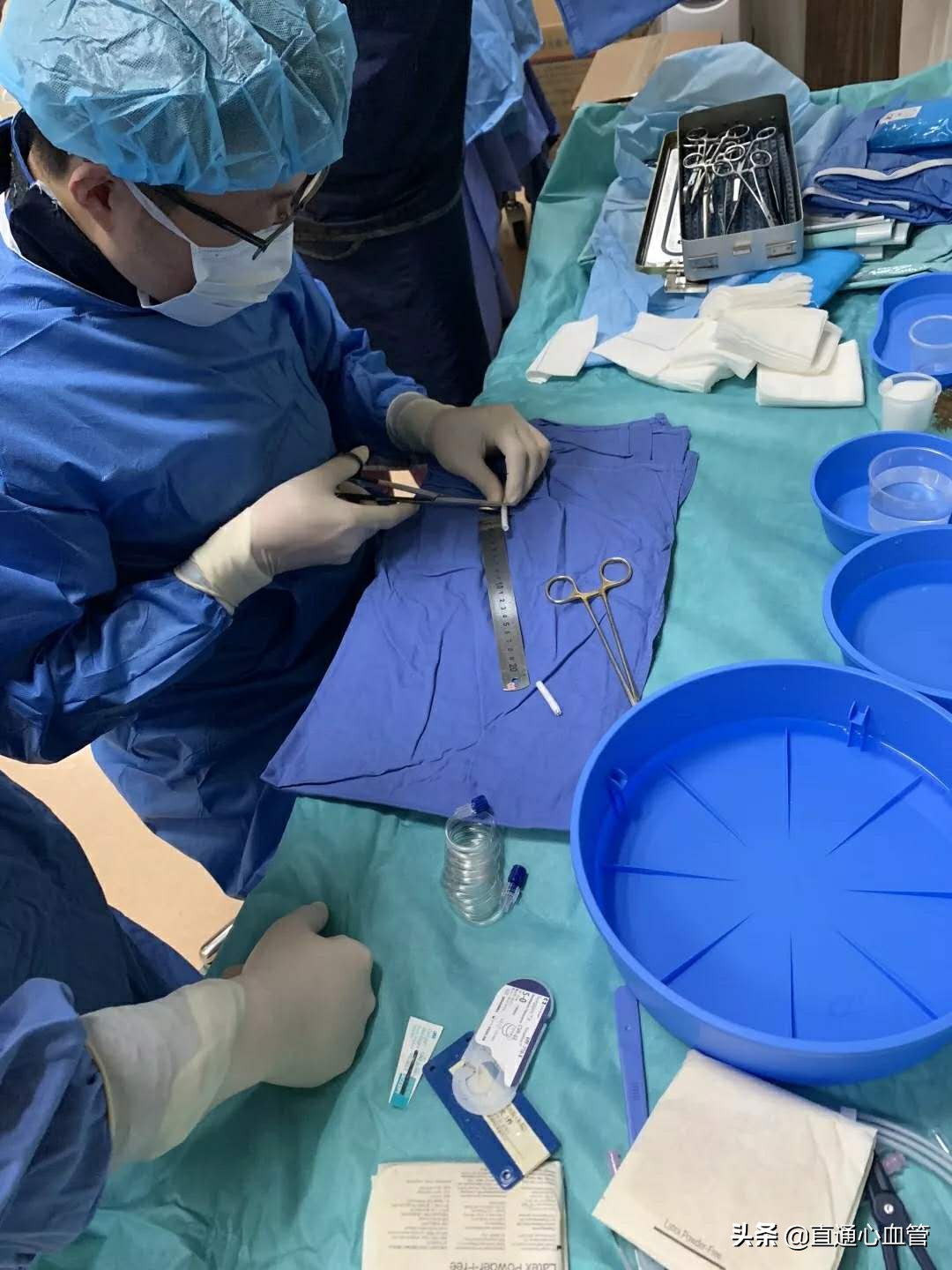 腔内“八爪鱼技术”治疗胸腹主动脉瘤！上海仁济医院血管外科叶猛团队自制“触角”完成高难度腔内隔绝术