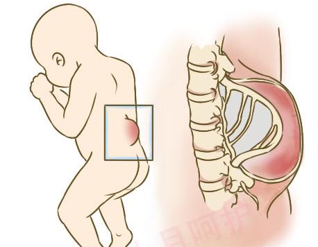 「讨论」做产检时发现胎儿畸形，该怎么办，到底生还是不生？