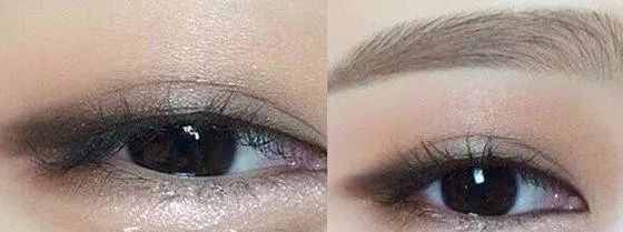 眼睛小是因为什么原因要怎么解决,眼睛小怎么办最有效的方法