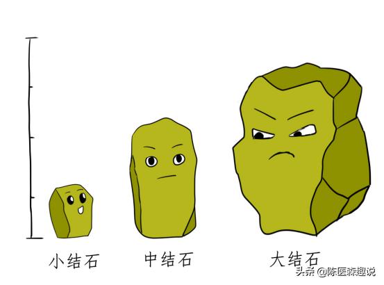 发现肾结石怎样治疗更好,发现肾结石怎么办