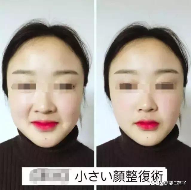 脸大真的不如脸小的好看吗,脸小真的显瘦吗