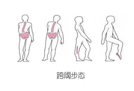 走路看起来像街溜子,走路为什么像街溜子