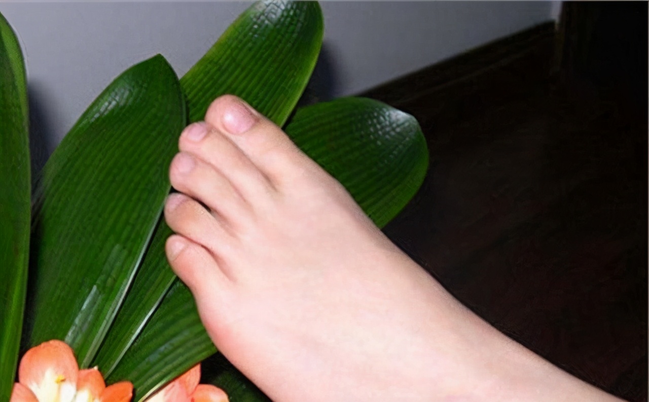 怎么证明没脚气,没有药如何处理脚气