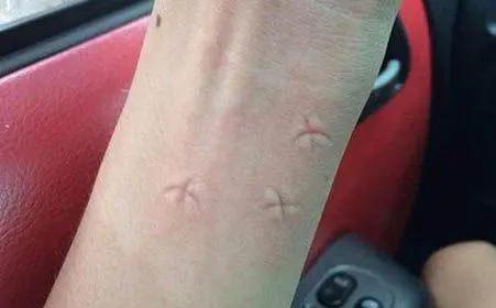 用什么方式灭蚊子,灭蚊子最有效的土方法