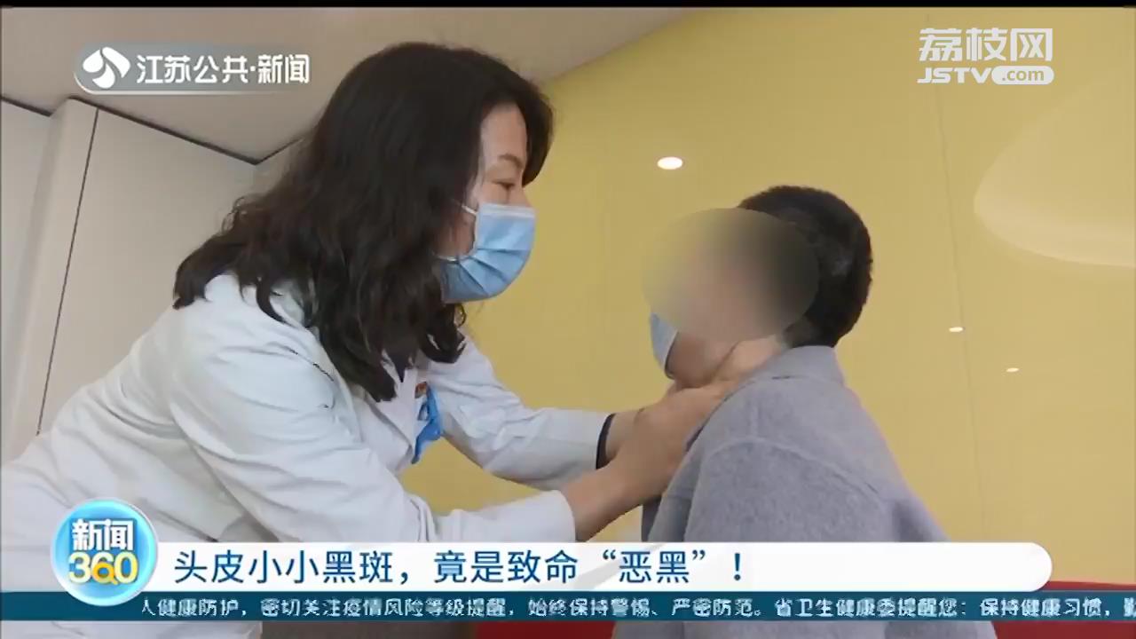 头皮黑色素瘤原因,头皮黑痣长大了怎么办