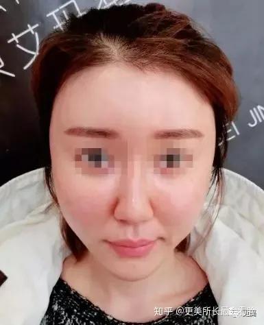 医美焦虑有哪些,医美冥想