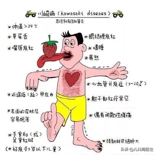 川崎病的孩子为啥容易感冒,怎样确诊儿童得了川崎病