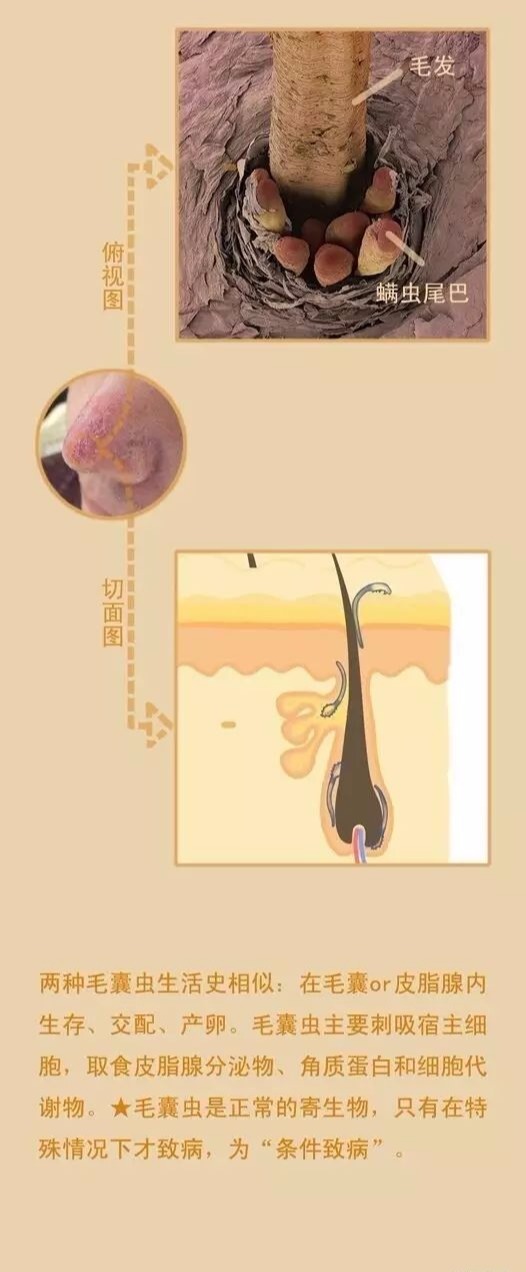 螨虫真的有必要除吗,真的有这么多螨虫吗辟谣