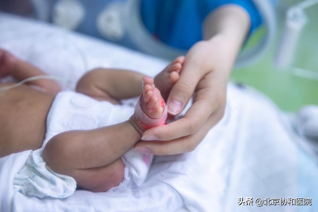 胎儿先天性乳糜胸保守治疗成功率,胎儿乳糜胸预后怎样