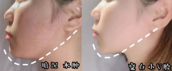 不老女神明星李英爱,51岁李英爱冻龄神颜的原因