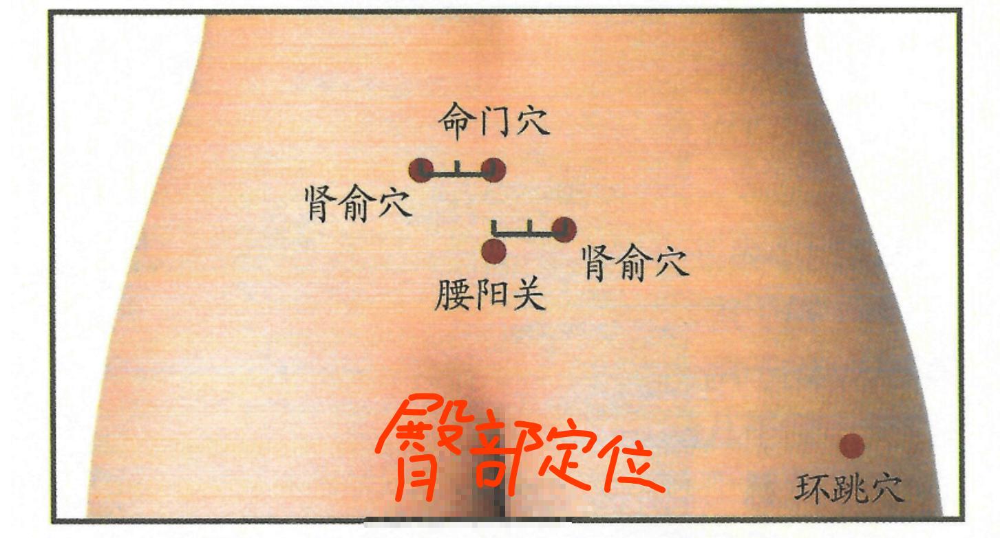 腰肌劳损艾灸治疗，干重体力活的人重灸肾俞别忘记环跳穴效果加倍