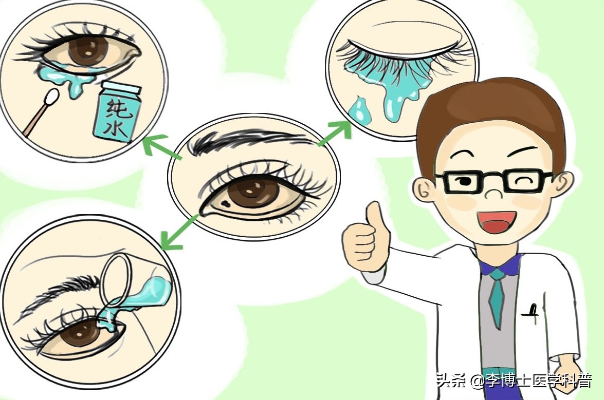 眼科专家教你三步法处理异物入眼，一定要收藏