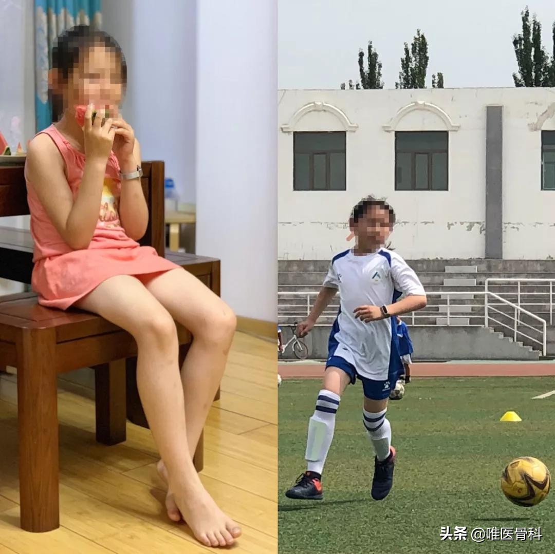 怎样练成逆天大长腿,怎样从小短腿练成大长腿