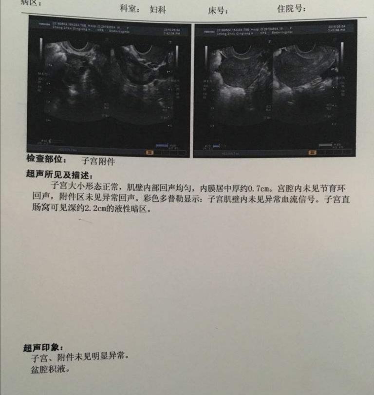 女性盆腔积液腹痛用什么药最好,女人之痛是什么