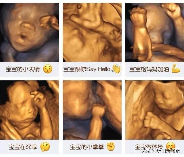 “你的宝贝”拍了拍你说：妈妈快带我去现代妇产医院做四维啦