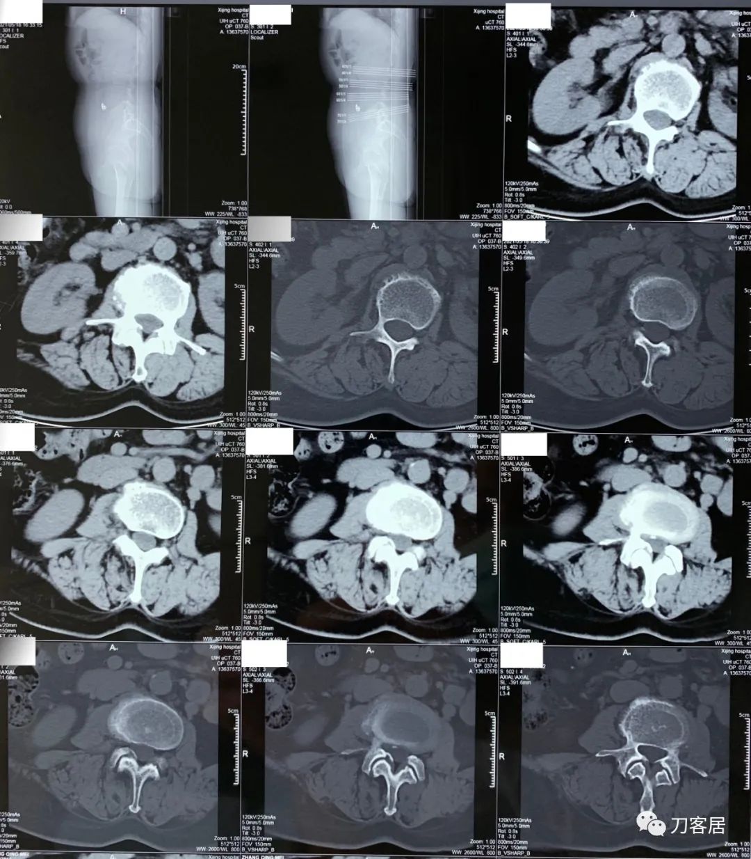 我的门诊病历,我的门诊