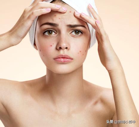 你不知道的祛痘好药,治疗痘痘别心急