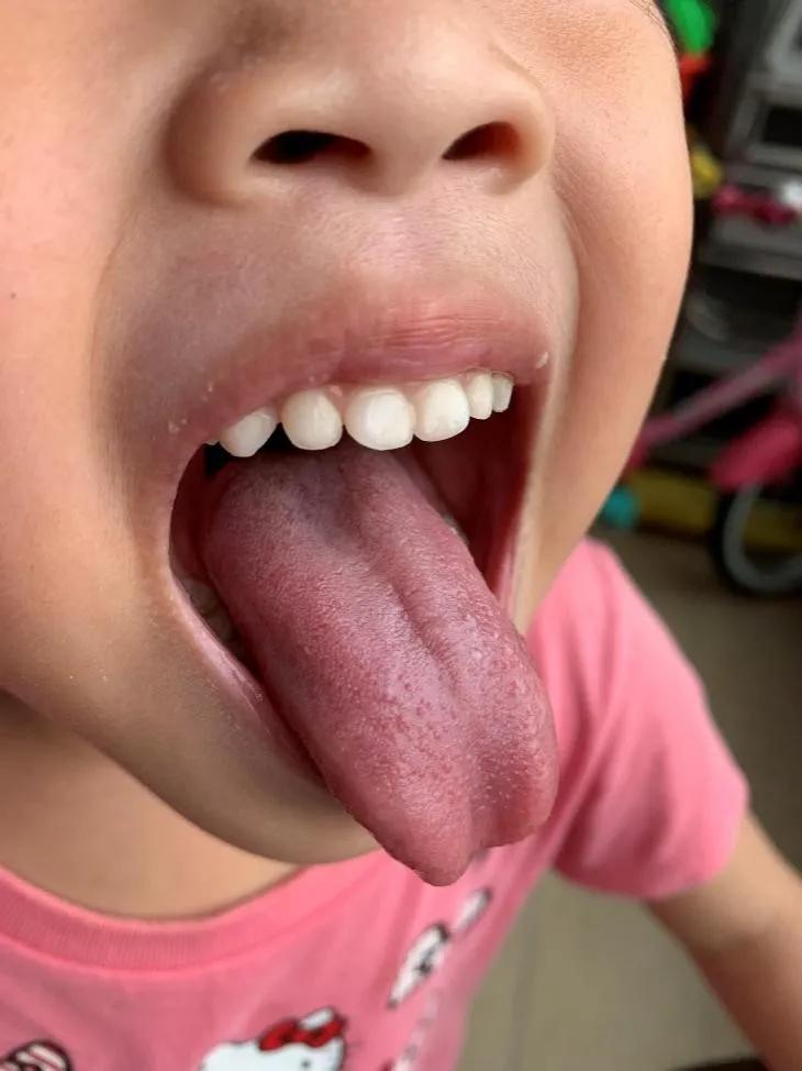 小孩子总时不时咳一两声为什么,孩子晚上睡觉咳两声晨起咳两声