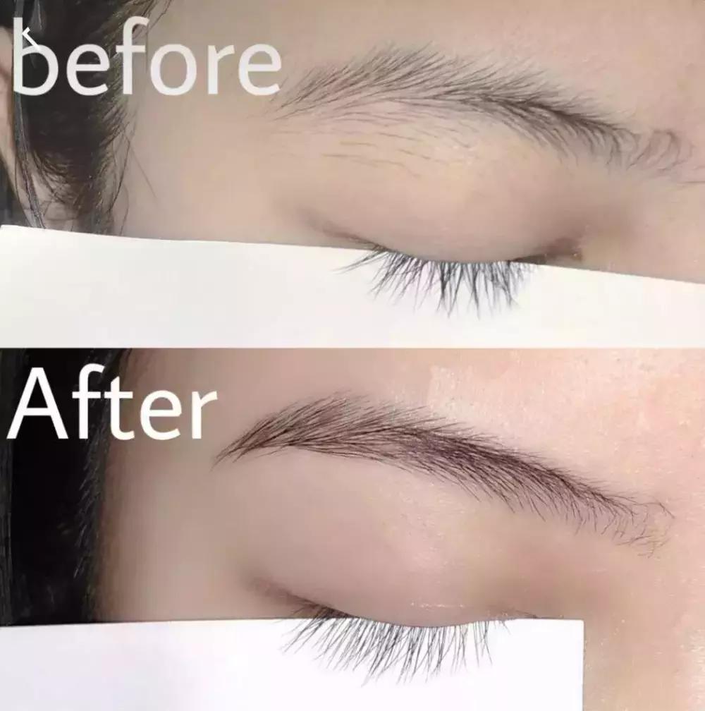 欧阳娜娜安利的能量棒,欧阳娜娜祛痘膏多少钱